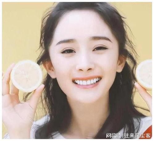明星网红矫正牙齿钢牙,钢牙背后的美丽蜕变